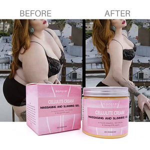 Crème amincissante MOPOYAT en gros pour le traitement de la <span class=keywords><strong>cellulite</strong></span>, le remodelage corporel, la perte de poids, la relaxation musculaire, le massage corporel, marque privée - Product Image 4
