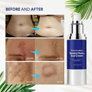Crema Personalizada con Logotipo de Belleza Orgánica para <span class=keywords><strong>Embarazo</strong></span>, Antiarrugas, Blanqueadora, Suavizante, Hidratante, Elimina Cicatrices y Estrías - Product Image 3