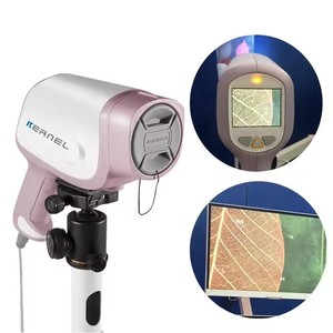 Colposcopio digital aprobado CE, colposcopio de vídeo Full HD 4K para Carro de ginecología, <span class=keywords><strong>colposcopia</strong></span> para <span class=keywords><strong>obstetricia</strong></span> y ginecología - Product Image 2