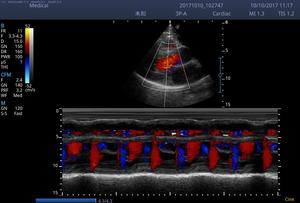 Échographe vétérinaire portable Sonoscape E3V E3 Doppler couleur avec imagerie microvasculaire SR Flow pour animaux de grande et petite taille - Product Image 6