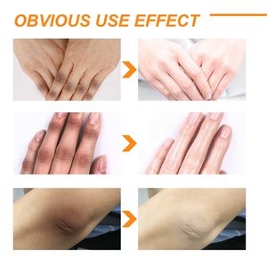 Exfoliación instantánea para nudillos oscuros, vitamina C, blanqueamiento de la piel negra, crema corporal con ácido hialurónico - Product Image 3