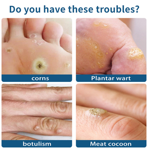 Parche Curativo <span class=keywords><strong>para</strong></span> Eliminar Callosidades en los Pies, Alivio del Dolor, Protección contra Callosidades - Product Image 3