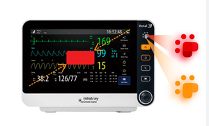 पशु के लिए सह 2 वाटल 3 पोर्टेबल मॉनिटर के बिना सह 2 वाटल 3 पोर्टेबल मॉनिटर पशु के लिए - Product Image 2