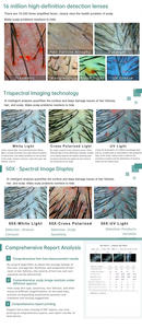 Analizador de Cuero Cabelludo Inteligente con IA, Oferta Económica, Cuantifica el Grado de Pérdida de Cabello, Genera Planes de Cuidado, Imprescindible para Clínicas de Trasplante Capilar - Product Image 2