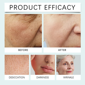 Crème hydratante douce pour le soin de la peau du visage, hydratante, élastique et délicate. - Product Image 3