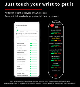 สมาร์ทวอทช์ F240 ตรวจวัดคลื่นไฟฟ้าหัวใจ (ECG) วิเคราะห์องค์ประกอบร่างกาย วัดออกซิเจนในเลือด ตรวจวัด HRV รองรับโหมดกีฬามากกว่า 150 โหมด หน้าจอ HD ขนาด 1.55 นิ้ว เพื่อการ<span class=keywords><strong>จัดการ</strong></span>สุขภาพ - Product Image 5