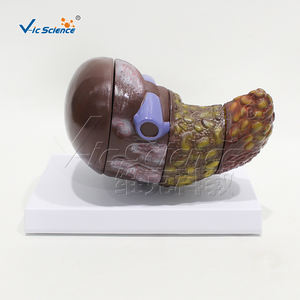 Modelo hepático doente (quatro estágios) hepatite crônica - Product Image 4