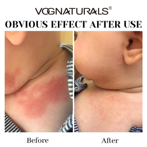 Crema multivitamínica Óxido de zinc Escudo todo el día Protector de mejillas para bebés Manzanilla orgánica Alivia el alivio Crema mágica Bloqueo de humedad - Product Image 5