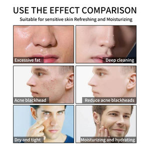 Hamamelis <span class=keywords><strong>โฟม</strong></span><span class=keywords><strong>ล้าง</strong></span><span class=keywords><strong>หน้า</strong></span>สำหรับ<span class=keywords><strong>ผู้ชาย</strong></span>ออแกนิคทำจากธรรมชาติสำหรับผิวมันแห้งทำให้ผิว<span class=keywords><strong>หน้า</strong></span>กระจ่างใส - Product Image 6