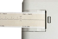 CONTEC ECG100G Monitor de ECG Portátil, Electrocardiógrafo, Máquina de ECG, Dispositivos de ECG para el Hogar