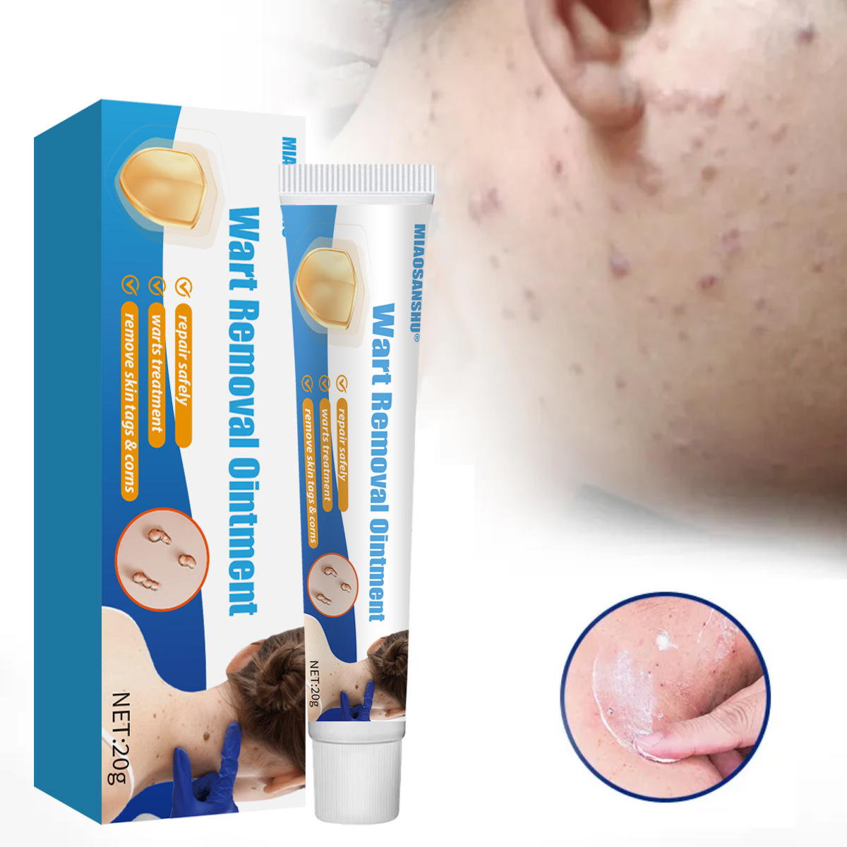 OEM/ODM MIAOSANSHU MSDS Certified Anti-Itch Cream Balm-Topical Care for Body Armpit & Tinea Discomfort