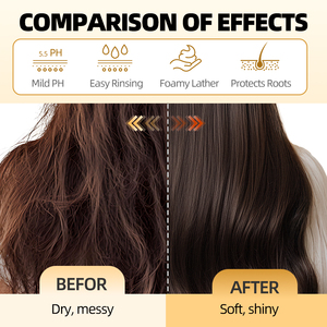 Barre de shampooing anti-pelliculaire, échantillon gratuit, meilleure vente, traitement rafraîchissant contre la perte de cheveux pour cheveux gras, lisse les cheveux avec de l'huile solide d'arbre à thé au romarin - Product Image 5