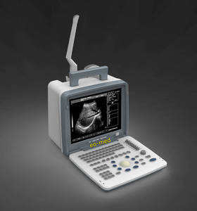 Siêu âm con người y tế màu đen và trắng siêu âm di động máy siêu âm xách tay máy quét bw300 - Product Image 4