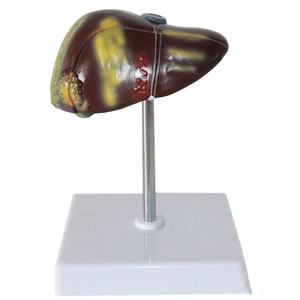 Патологическая модель печени человека, рак печени для школы, медицинский обучающий дисплей, лабораторное оборудование - Product Image 2