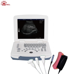 Escáner de Ultrasonido Veterinario Digital de Alta Definición, Adecuado para el Examen del Hígado, la Tripa, los Riñones, el Útero y la Vejiga de Mascotas - Product Image 1