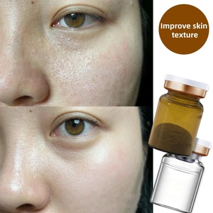 ผงก40% ำจัดสิวเสี้ยนขัดผิวกำจัดคราบจุลินทรีย์ที่ทำให้ผิวขาว - Product Image 4