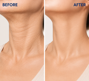 Crema para el Cuello ECM-Plus 50g, Colágeno y Elastina, Reafirmante e Hidratante para Piel Flácida, Líneas Finas, Piel Radiante - Product Image 6