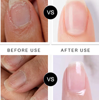 Produits de soin des ongles coréens en gros, stylo personnel pour le traitement des mycoses des ongles des pieds et des doigts, stylo réparateur d'huile pour cuticules