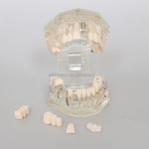 <span class=keywords><strong>Prix</strong></span> usine Transparent <span class=keywords><strong>adulte</strong></span> pathologie dentaire dents modèle prothèse modèle d'enseignement modèle dents - Product Image 4