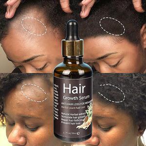 Óleo Sérum de Gengibre para Crescimento Capilar em 7 Dias Marca Própria para Pessoas Negras Tratamento do Couro Cabeludo Óleo de Alta Qualidade para Reparação do Folículo Piloso - Product Image 4