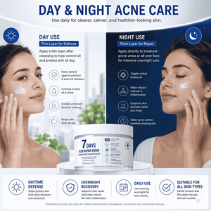 Crema Reparadora para el Acné 7 Días de Korea Skincare, Tratamiento Anti-Espinillas, <span class=keywords><strong>Corrector</strong></span> de Manchas Oscuras, Crema Facial <span class=keywords><strong>No</strong></span> Comedogénica para Piel Sensible - Product Image 5