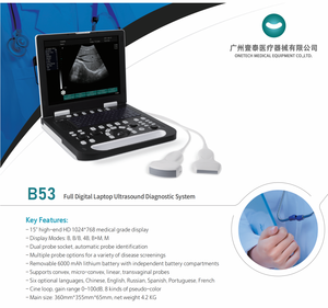B53 giá thấp SONOSCAPE xách tay siêu âm DOPPLER Máy quét cho doanh số bán hàng - Product Image 3