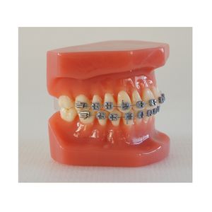 Dentaire Typodont Dents Modèle D'étude Modèle Orthodontique avec Supports En Métal - Product Image 3