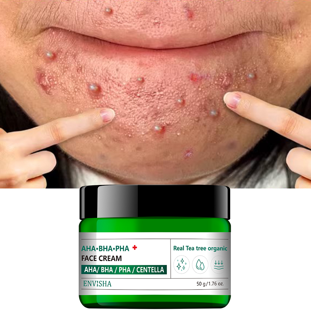 Facial Pore Minimizing Cream Oil Control Shrink Pores Moisturizing Scar Removal Whitening Face Cream