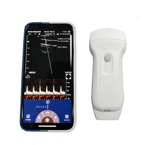 Konted Wifi & Usb-Verbinding Mini Draagbare Ultrasone <span class=keywords><strong>Machine</strong></span> Detecteren Voor Vasculaire/Nier/Hart - Product Image 3