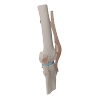 Science médicale arthrose anatomie pathologique PVC artificiel flexible taille réelle squelette humain modèle anatomique de l'articulation du genou