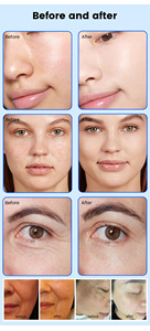 Máquina Profesional de Terapia de Plasma Multifunción con 8 Puntas para Pigmentación, Reducción de Cicatrices, Eliminación de Arrugas y Cuidado del Cuero Cabelludo - Product Image 5