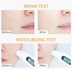 Crema de Lujo con Cúrcuma y Vitamina C: Mejora las Manchas Oscuras y las Cicatrices del Acné, Repara la Piel - Product Image 4