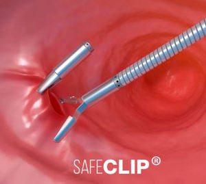 CE gastroenteroloji endoskop sarf malzemeleri ile Hemoclip kolonoskopi - Product Image 2