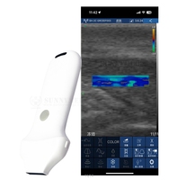 Sonde d'échographie portable sans fil 20 Hz à 192 éléments pour soins esthétiques de la peau