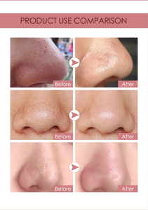 Strisce per la rimozione dei <span class=keywords><strong>punti</strong></span> <span class=keywords><strong>neri</strong></span>/Maschera per il naso per affinare i pori/Maschera per il naso per aspirare i <span class=keywords><strong>punti</strong></span> <span class=keywords><strong>neri</strong></span> - Product Image 2