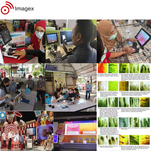 毛細血管顕微鏡の研究ビデオキャピラロスコープ、ネールフォールド血流および微小循環のための分析ソフトウェア付き - Product Image 5