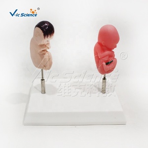 Modelo de Contraste de Feto Saludable vs. Feto Fumador para Educación Obstétrica Hospitalaria CE/ISO/ROHS/CNAS - Product Image 1