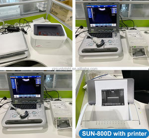 Sunbright à bas prix pour le diagnostic de l'ordinateur portable 15 pouces machine à ultrasons numérique <span class=keywords><strong>3D</strong></span> - Product Image 6