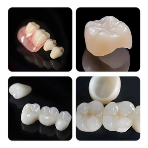 Resina Bio-Nano Ceramica Over-Crown per Corone e Ponti Dentali Stampati in 3D, Purezza 100%, Durata 36 Mesi - Product Image 3