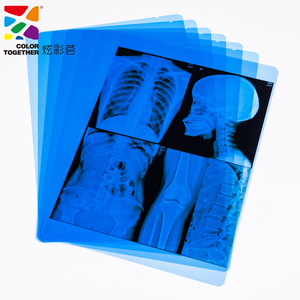 Satılık tıbbi kullanım için Fujifilm kuru Film <span class=keywords><strong>X</strong></span> <span class=keywords><strong>Ray</strong></span> tıbbi termal Film yazıcı - Product Image 4