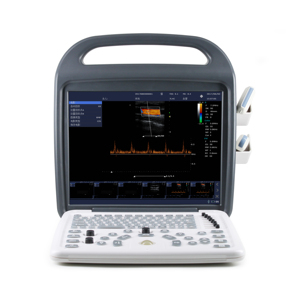 Mesin pemindai <span class=keywords><strong>Ultrasound</strong></span> medis dokter hewan, mesin <span class=keywords><strong>Ultrasound</strong></span> Doppler warna layar 15 "dengan 2 Probe - Product Image 3