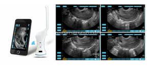 Grado impermeabile ad alta risoluzione elemento 128 convesso sonda MSLMY12 senza fili di colore Doppler ultrasuoni per clinica medica - Product Image 4