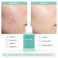 OEM/ODM para Suero Calmante/Aclarante con Ácido Azelaico 10 |   Piel con tendencia a la grasa y problemas de acné B3+B5 |   Cuidado de la Piel Chino para Mujeres 1.01 Fl oz
