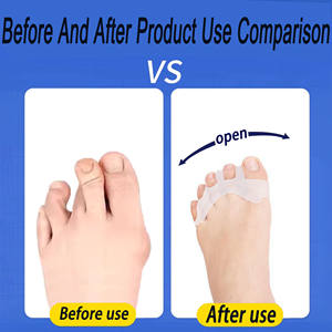Séparateurs d'orteils en gel pour usage quotidien, 4 séparateurs d'orteils en silicone, <span class=keywords><strong>protection</strong></span> contre les ampoules - Product Image 5