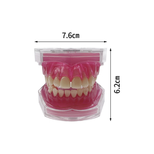 <span class=keywords><strong>Modello</strong></span> Anatomico Dentale Standard MX-039 con Denti Rimovibili, Tipo Dentale con Gengive Morbide per Studio, Insegnamento ed Educazione, Dimostrazione in Resina - Product Image 6