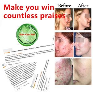 Gel d'Aloe Vera Biologique M, <span class=keywords><strong>Pulpe</strong></span> d'Aloe Vera Pure, Hydratant Apaisant pour la Peau et les Cheveux, Soin Apaisant Après-Soleil, Directement de Cosmetics - Product Image 4