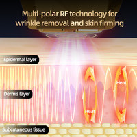 FITTOP Prix d'usine 1-3,3 MHz Appareil de massage facial RF pour le lifting, utilisation à domicile, appareil de beauté pour la réduction des rides