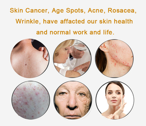 KN-7000D Y Tế cấp <span class=keywords><strong>LED</strong></span> Quang động trị liệu màu xanh/đỏ/hồng ngoại trẻ hóa da vẻ đẹp trên khuôn mặt <span class=keywords><strong>PDT</strong></span> máy - Product Image 5