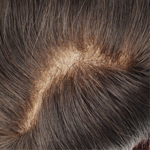 <span class=keywords><strong>Prótesis</strong></span> Capilares de Cabello Humano con Nudos Decolorados, de la <span class=keywords><strong>Mejor</strong></span> Calidad, con Encaje Francés Suizo de Aspecto Natural, Ultra Suizo, para Hombres - Product Image 2