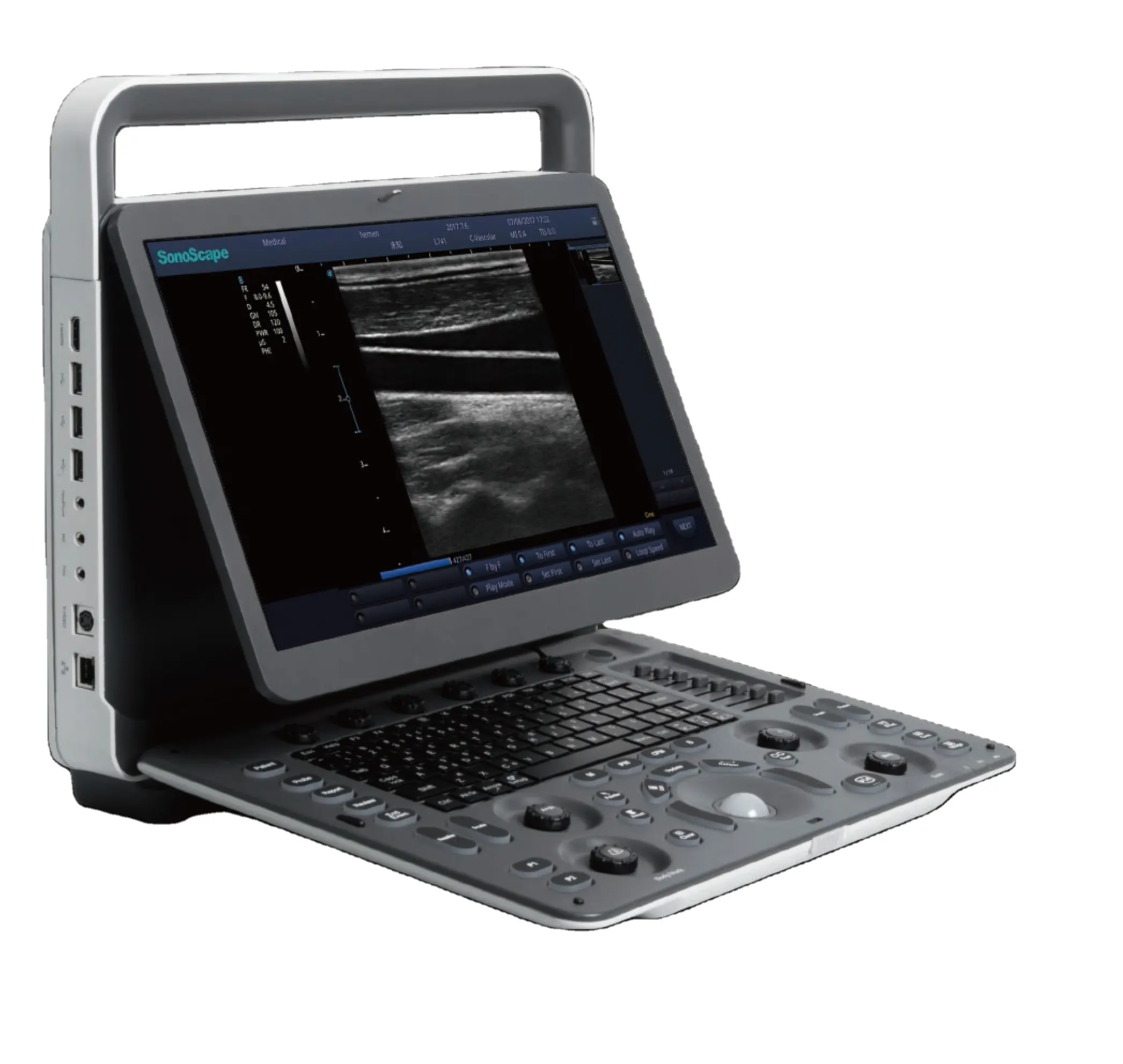 Laptop Sonoscape E1 Digital Ultrasound System/scanner portatile/Sonoscape ultrasound machine
